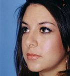 Rhinoplasty Before & After Patient #4803